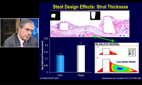 The SYNERGY Stent Design